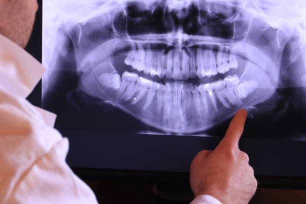 Best Emergency Dentist for Knocked-Out Tooth in Camp Hill, AL