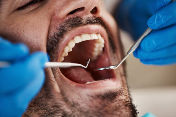 Best Emergency Dental Care for Abscessed Tooth in Camp Hill, AL