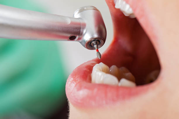 Best Weekend Emergency Dentist in Camp Hill, AL